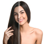 before and after collagen treatment