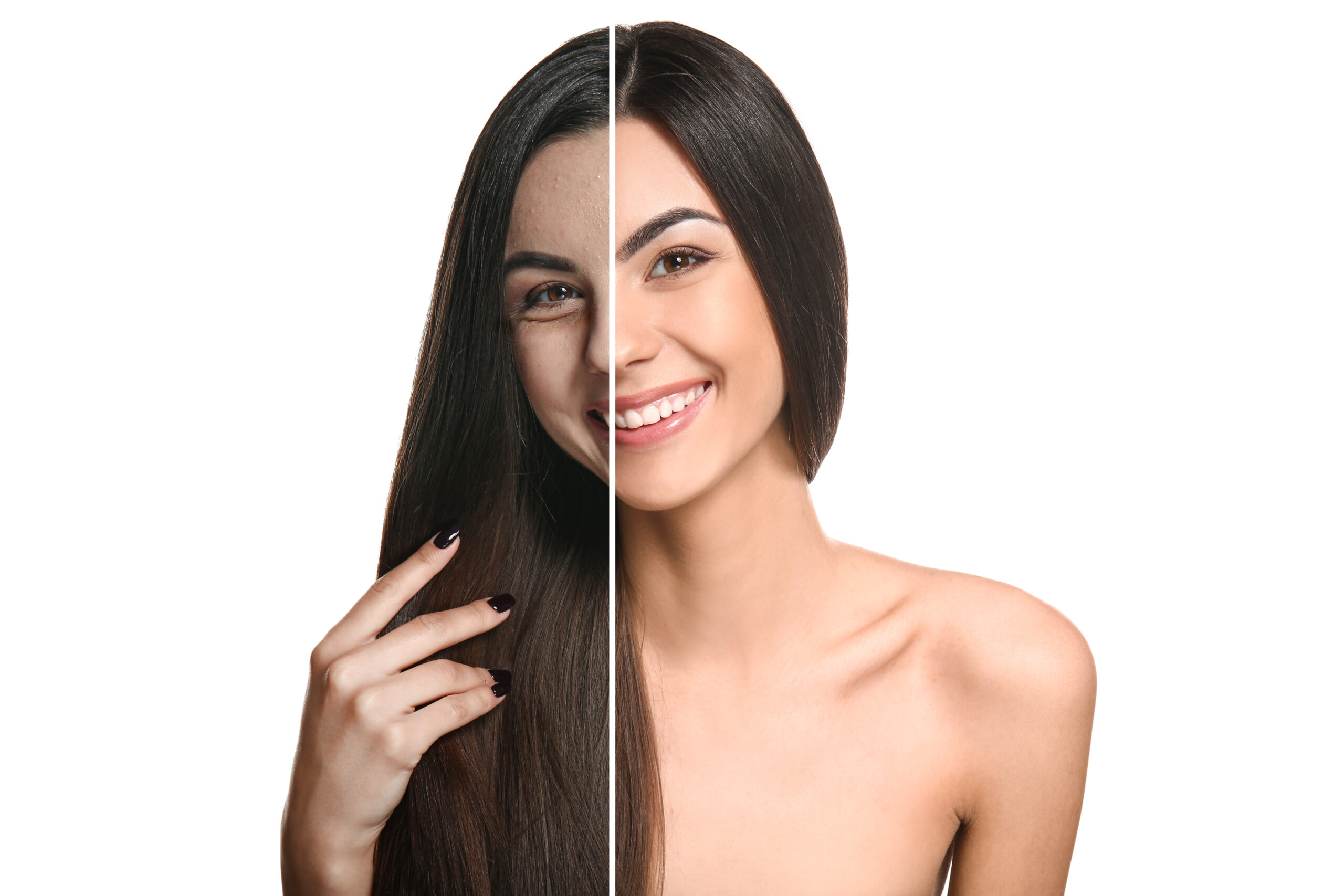 before and after collagen treatment